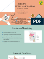 Karsinoma Nasofaring