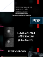 Carcinoma Medular, Mucinoso y Papilar Intraquístico PPT GM