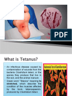 Tetanus