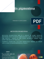 Retinitis Pigmentosa: Prepared By: Aditya Saxena