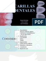 Exposicion Carillas Dentales