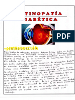 Retinopatía Diabética