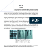 COVID-19 Pneumonia