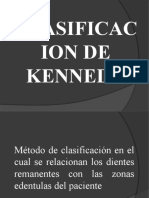 Clasificacion de Kennedy