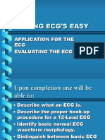 Ecg Made Easy