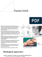 P4 Trauma Listrik - Annisa