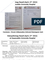 Histopathology Result (April, 27 2022) at Hasanuddin University Hospital