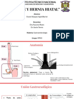 Erge y Hernia Hiatal