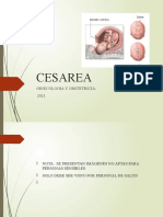 Cesarea 2021