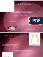 Mordida Cruzada Posterior PRESENTACION FINAL