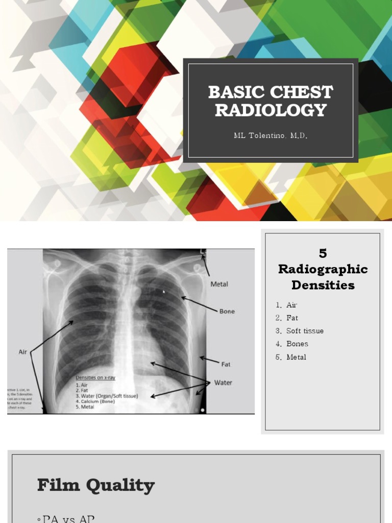 Basic Chest Radiology: ML Tolentino, M.D | PDF