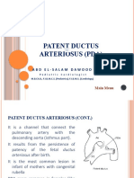 Pantent Ductus Arteriosus