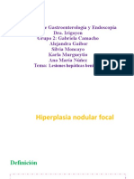 Hiperplasia Nodular
