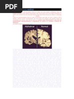 Alzheimer e o Xadrez