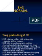 Ekg Gadar