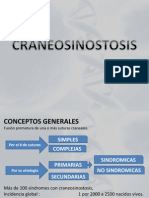 Craneosinostosis