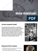 Brain Transplant