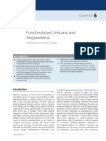 Food-Induced Urticaria and Angioedema