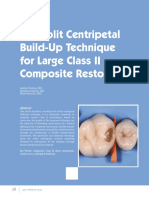 The Split Centripetal Build-Up Technique For Large Class II Composite Restorations
