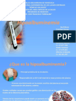 Hipoalbuminemia