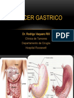 Cancer Gastrico Tumores