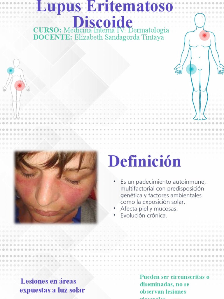 lupus-eritematoso-discoide-diagn-stico-y-tratamiento-pdf