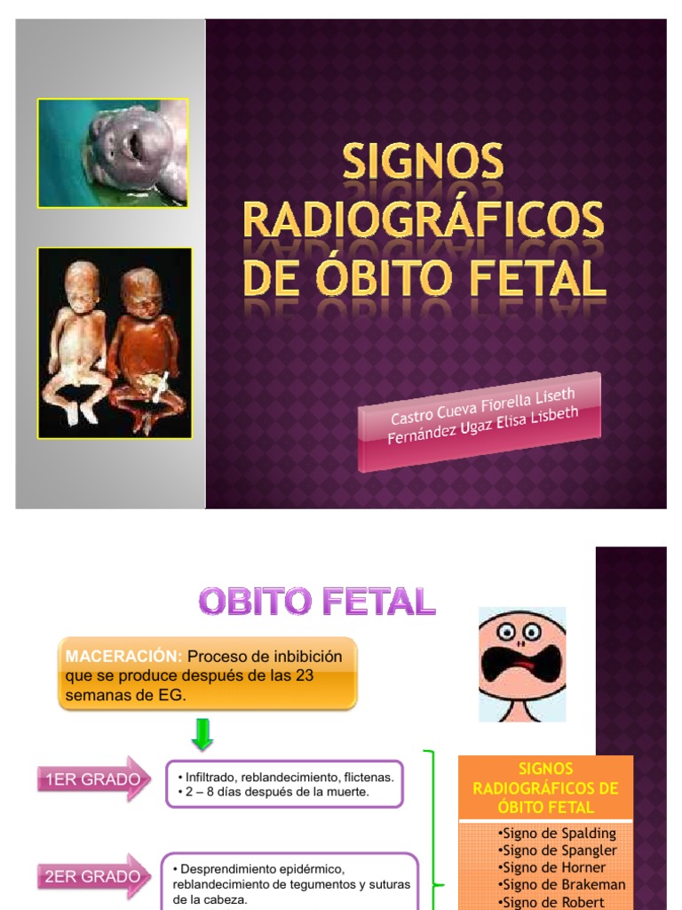 signos-radiogr-ficos-de-bito-fetal