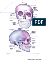 CT Scan