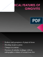 Clinical Features of Gingivitis