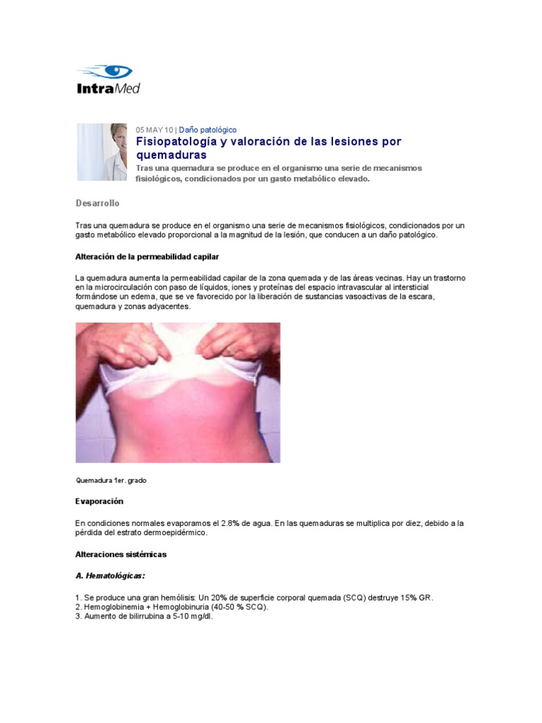 Fisiopatología y Valoración de Las Lesiones Por Quemaduras