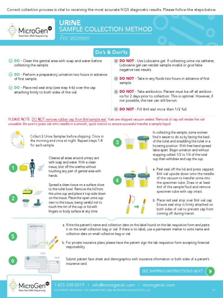 How To Collect An Urine Sample? – ECGZCE