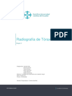 Radiografia de Torax-Grupo4