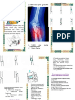 (Leaflet Fraktur) Yuli Nursiah 18010033