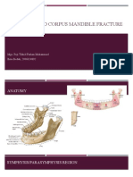 Symphysis and Corpus Mandible Fracture: Mgs. Puji Wahid Farhan Muhammad Ilmu Bedah, 2006624892