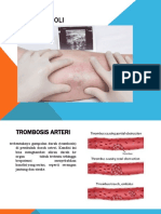Trombosis Arteri dan Emboli