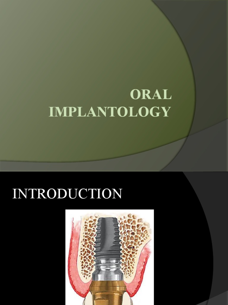 Oral Implantology PDF Dental Implant Biomaterial