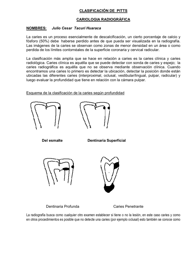 Clasificación de Pitts | PDF