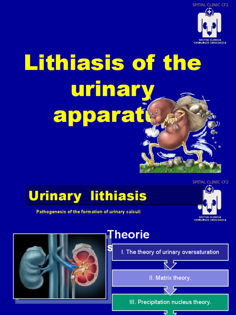 Urinary Lithiasis: Mechanisms and Treatment | PDF | Urine | Urology