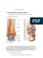 Rotura Doble Maleolar
