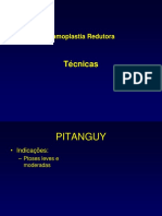 207577882-Mamoplastia-redutora