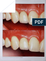 The International Journal of Periodontios & Restorative Dentistry
