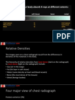 Chest X-Rays First Ranker