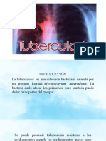 Presentacion de La Tuberculosis