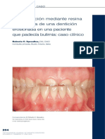 Rehabilitación Mediante Resina Compuesta de Una Dentición Erosionada en Una Paciente Que Padecía Bulimia: Caso Clínico
