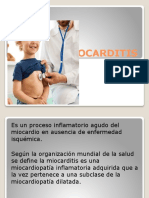 Miocarditis