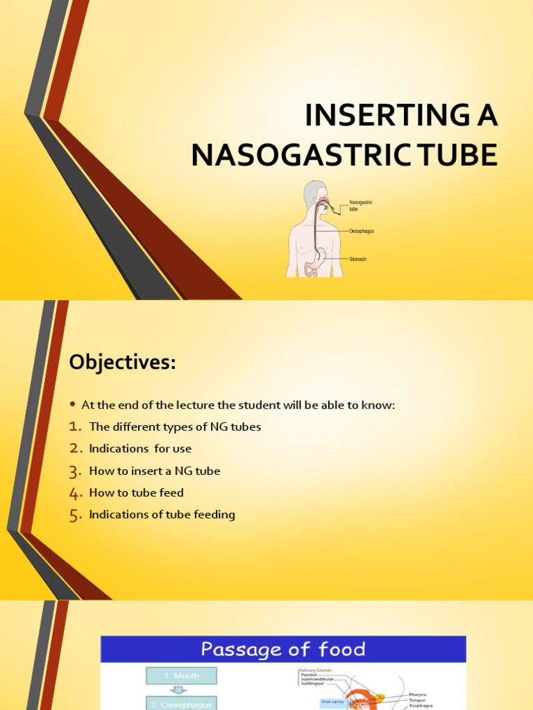Inserting A Nasogastric Tube PDF Gastroenterology Medical Specialties