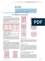 ECG_pour_les_nuls_partie_3