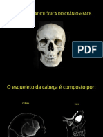 56523094 Anatomia Radiologica Dos Ossos Da Face e Cranio
