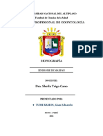 Monografía - Síndrome de Marfan Definitivo