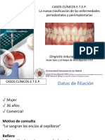 Gingivitis inducida por placa clasificada